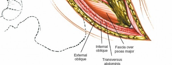 Illustration 147 for Approach to the Lumbar Spine: Mastering Techniques & Anatomy