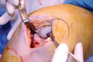 وصف طبي دقيق للمريض