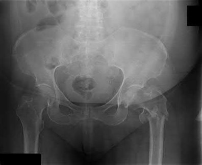 Illustration 108 for OrthoCash: Trauma MCQs & Cases for a yearold woman