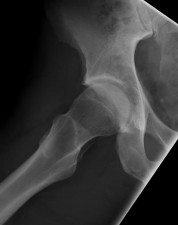 Sport Orthopedics Review | Dr Hutaif Sports Medicine Re -...