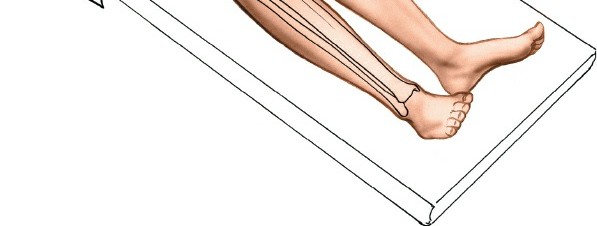Illustration 58 for Surgical Access: Mastering the Tibia's Surface & Fibula Approaches
