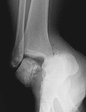 Illustration 5 for OrthoCash: Trauma MCQs & Cases for a yearold woman