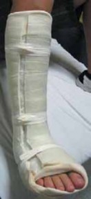 Illustration 10 for Pediatric Ankle Fractures: Management to Prevent Long-Term Issues