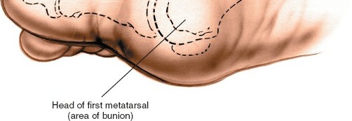 Illustration 200 for Optimized Approaches to the Dorsum of the Foot & Ankle