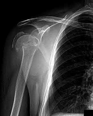 Illustration 209 for OrthoCash: Trauma MCQs & Cases for a yearold woman