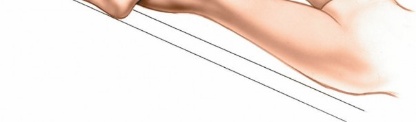 Illustration 64 for Mastering Knee Approaches: Spotlight on Superficial Medial Ligament