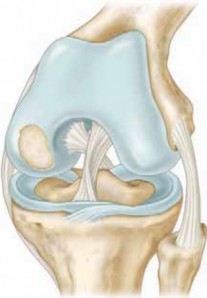Illustration of holes are made - Dr. Mohammed Hutaif
