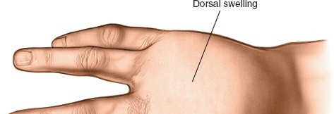 Illustration 204 for Essential Surgical Approaches: Uncover Every Aspect of the Wrist