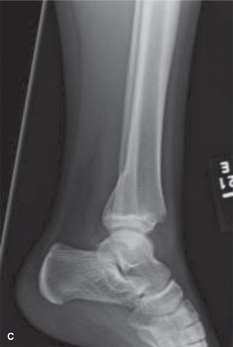Illustration 5 for 9 Pediatrics Cases: Essential Insights on Rotation of the Foot