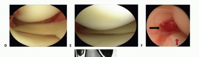Illustration 2 for Repair & Recover from Collateral Ligament Injuries: Your Guide