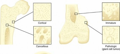 Illustration of biology of bone - Dr. Mohammed Hutaif