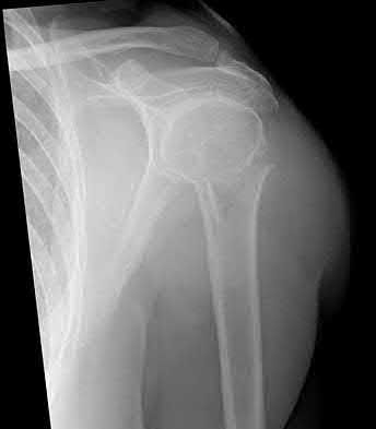 Illustration 180 for OrthoCash: Trauma MCQs & Cases for a yearold woman