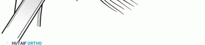 Illustration 14 for Latarjet for Instability: Bone Loss Solutions, Per Burkhart SS, Lo