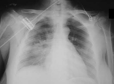 Illustration 132 for OrthoCash: Trauma MCQs & Cases for a yearold woman