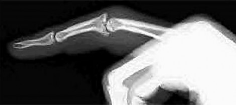 صورة طبية: دليل الأستاذ الدكتور محمد هطيف الشامل لأمراض وإصابات اليد والمعصم في صنعاء