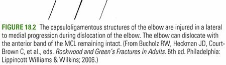 Elbow Dislocation: Understanding Your Injury for a Healthy Elbow