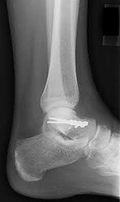 Illustration 121 for OrthoCash: Trauma MCQs & Cases for a yearold woman