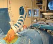 Illustration 11 for Regain Stability: Anterior Shoulder Instability Arthroscopic Fix