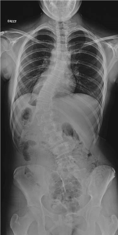 Illustration 22 for Ace FRCS Orthopaedics: Oxford University Press Adult Pathology Viva