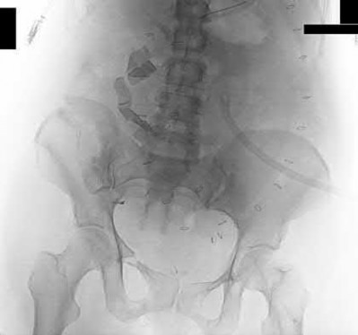 Illustration 198 for OrthoCash: Trauma MCQs & Cases for a yearold woman