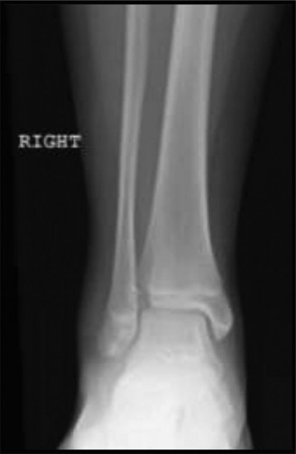 Unraveling 10 Pediatric Cases: Surgical Reduction and Internal Fixation