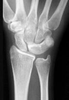 صورة طبية: دليل الأستاذ الدكتور محمد هطيف الشامل لأمراض وإصابات اليد والمعصم في صنعاء