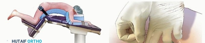 Lumbar Discectomy: Relieve Your Lumbar Disc Herniation Pain