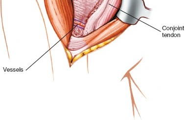 Illustration 23 for Essential Guide: Mastering Every Approach to the Shoulder