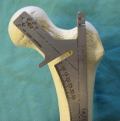 Illustration 5 for Cemented Femoral Stem Figures: Surgical Anatomy & Placement