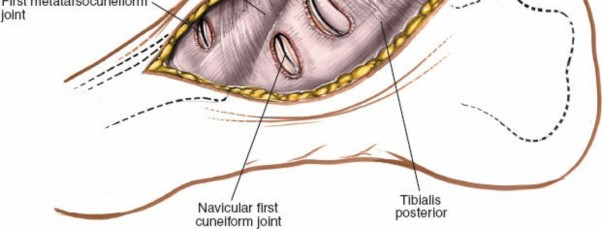Illustration 186 for Optimized Approaches to the Dorsum of the Foot & Ankle