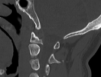 Illustration 37 for Master Orthopedic Spine Cases: Sharpen Your Diagnostic Skills