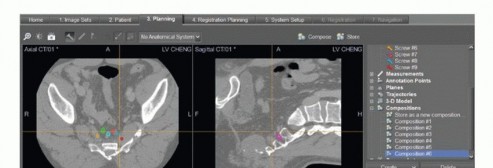 Illustration 46 for Sacral Tumor Surgery: Safeguarding Bowel & Bladder Control