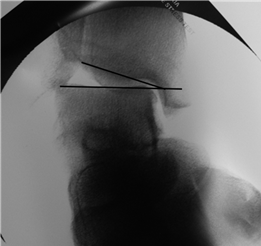 Illustration 23 for First Metatarsal Surgery: Expert Solutions for Foot & Ankle Pain