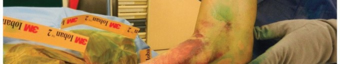 Illustration 13 for Radial Head & Neck Fractures: Mastering ORIF for Best Results