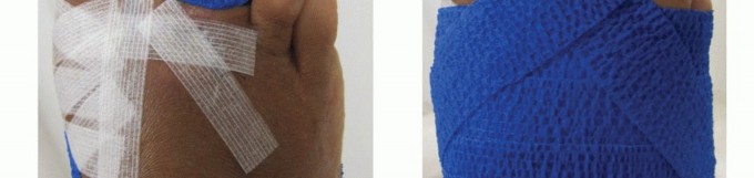 Illustration 45 for Plantar Plate Repair: End Lesser Toe Pain & Instability