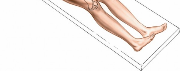 Illustration 8 for Unlocking Every Aspect of the Hip's Surgical Approaches