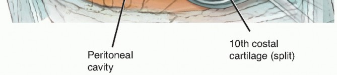 Anterior Thoracic Approach: Precision for Challenging Thoracic Issues