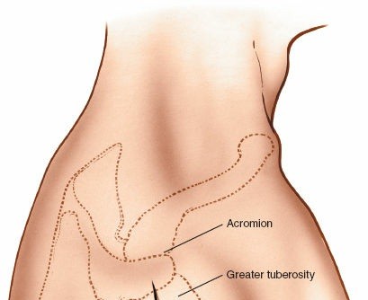 Illustration 101 for Essential Guide: Mastering Every Approach to the Shoulder