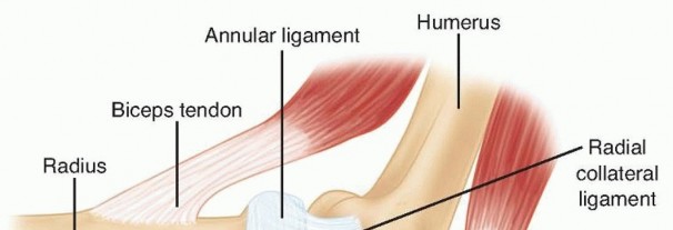 Radial Head Replacement