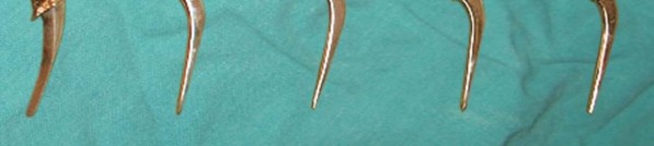 Illustration 18 for Mastering Hip Arthroplasty: Its Evolution and Design Unveiled