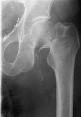 Illustration 32 for OrthoCash: Trauma MCQs & Cases for a yearold woman