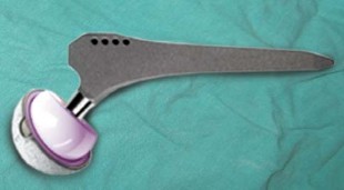 Illustration 54 for Mastering Hip Arthroplasty: Its Evolution and Design Unveiled