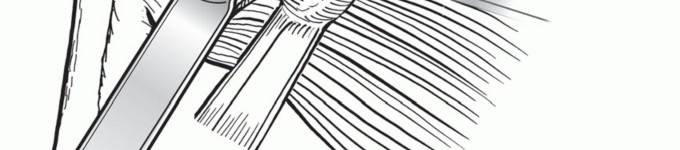 Illustration 13 for Latarjet for Instability: Bone Loss Solutions, Per Burkhart SS, Lo