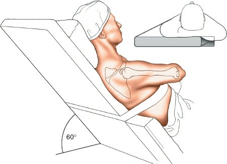 Illustration 214 for Essential Guide: Mastering Every Approach to the Shoulder