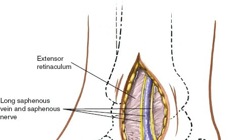 Illustration 18 for Optimized Approaches to the Dorsum of the Foot & Ankle