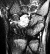 صورة طبية: دليل الأستاذ الدكتور محمد هطيف الشامل لأمراض وإصابات اليد والمعصم في صنعاء