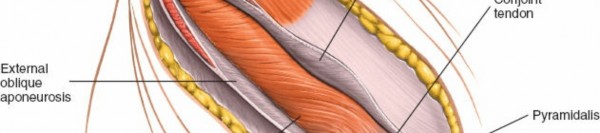 Illustration 12 for Ilioinguinal Approach: Master the Deep Inguinal Ring for Success