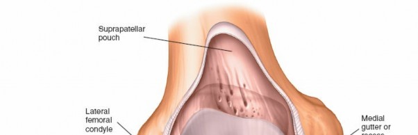 Illustration 11 for Mastering Knee Arthroscopy Approaches: Safely Withdraw the Arthroscope