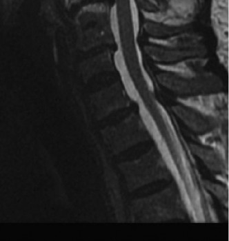 Illustration 4 for Master Orthopedic Spine Cases: Sharpen Your Diagnostic Skills