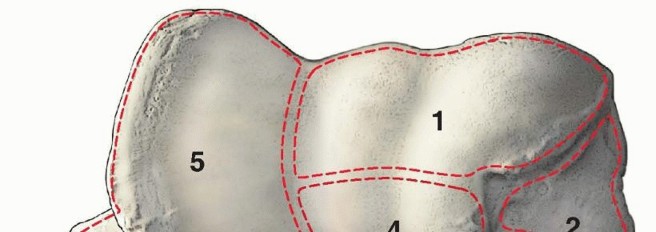 Illustration 3 for Navigating Capitellum and Capitellar-Trochlear Shear Fracture Repair